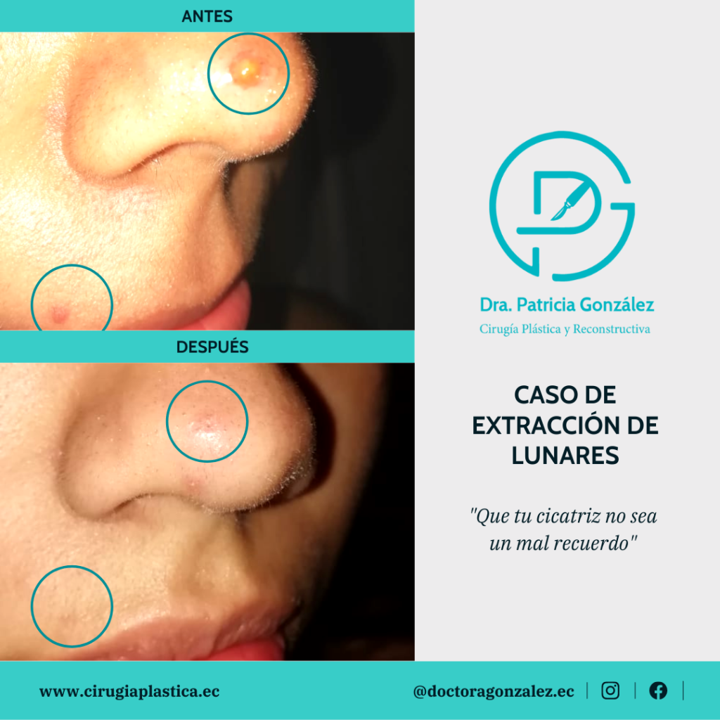 Plantillas DRAPG Celular (4)[2316]